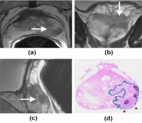 mri-image1