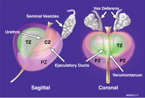 Zonal anatomy of a normal prostate gland