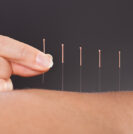 Acupuncture for BPH - Sperling Prostate Center