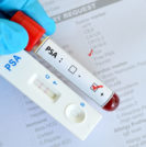 How Effective is the PSA Test? - Sperling Prostate Center