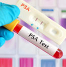 How Effective is the PSA Test? - Sperling Prostate Center