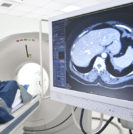 MRI prostate cancer treatment - Sperling Prostate Center