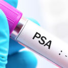 PSA test and prostate cancer