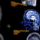 Gadolinium | Sperling Prostate Center