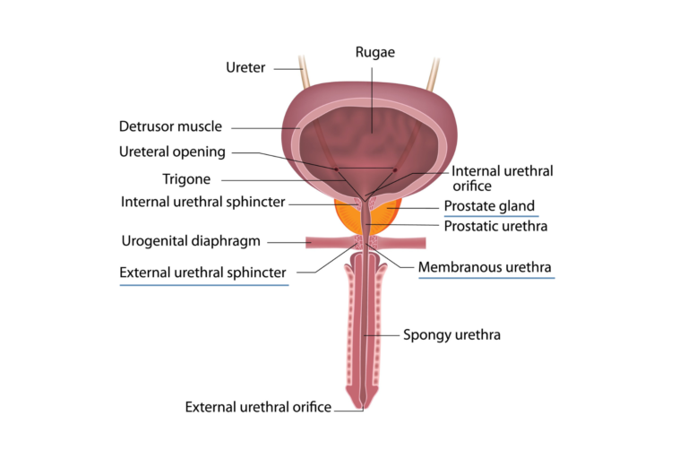 MRI Predicts Incontinence after Radical Prostatectomy - Sperling ...