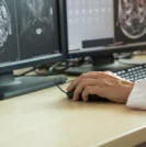 Radiologist interpreting MRI images of the prostate